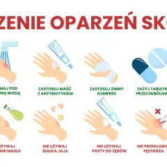 Ilustracja pokazuje, jak leczyć oparzenia skóry: chłodna woda, maść z antybiotykiem, zimny kompres, tabletki przeciwbólowe i aloes są zalecane. Unikaj masła, jajka, pasty do zębów, przekłuwania pęcherzy i lodu.