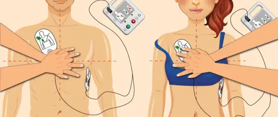 AED co to jest i jak działa w nagłym zatrzymaniu krążenia?